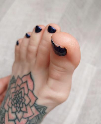Misery for Ann – footmodels.top