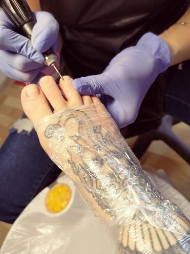 Misery for Ann – footmodels.top