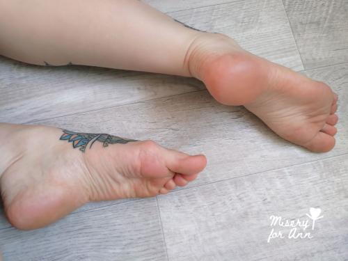 Misery for Ann – footmodels.top